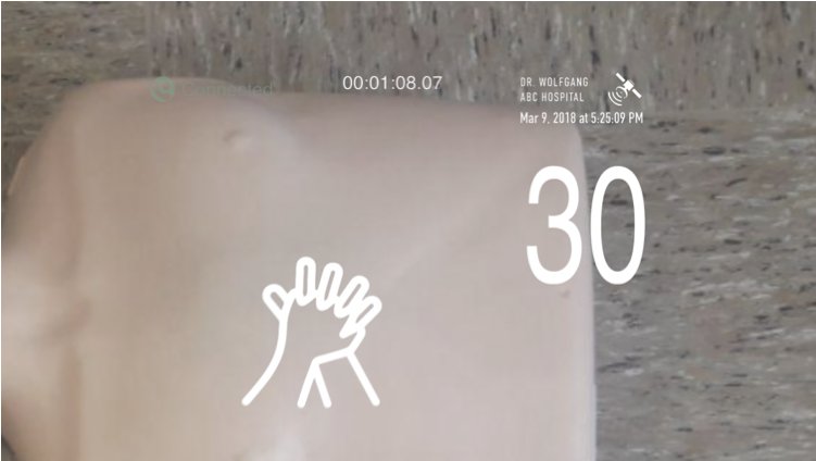 View through the AR headset during CPR practice: a compression counter at 30, hand-position icon, and clinician telepresence info